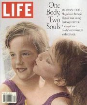 Life magazine cover: Abby and Brittany Hensel
